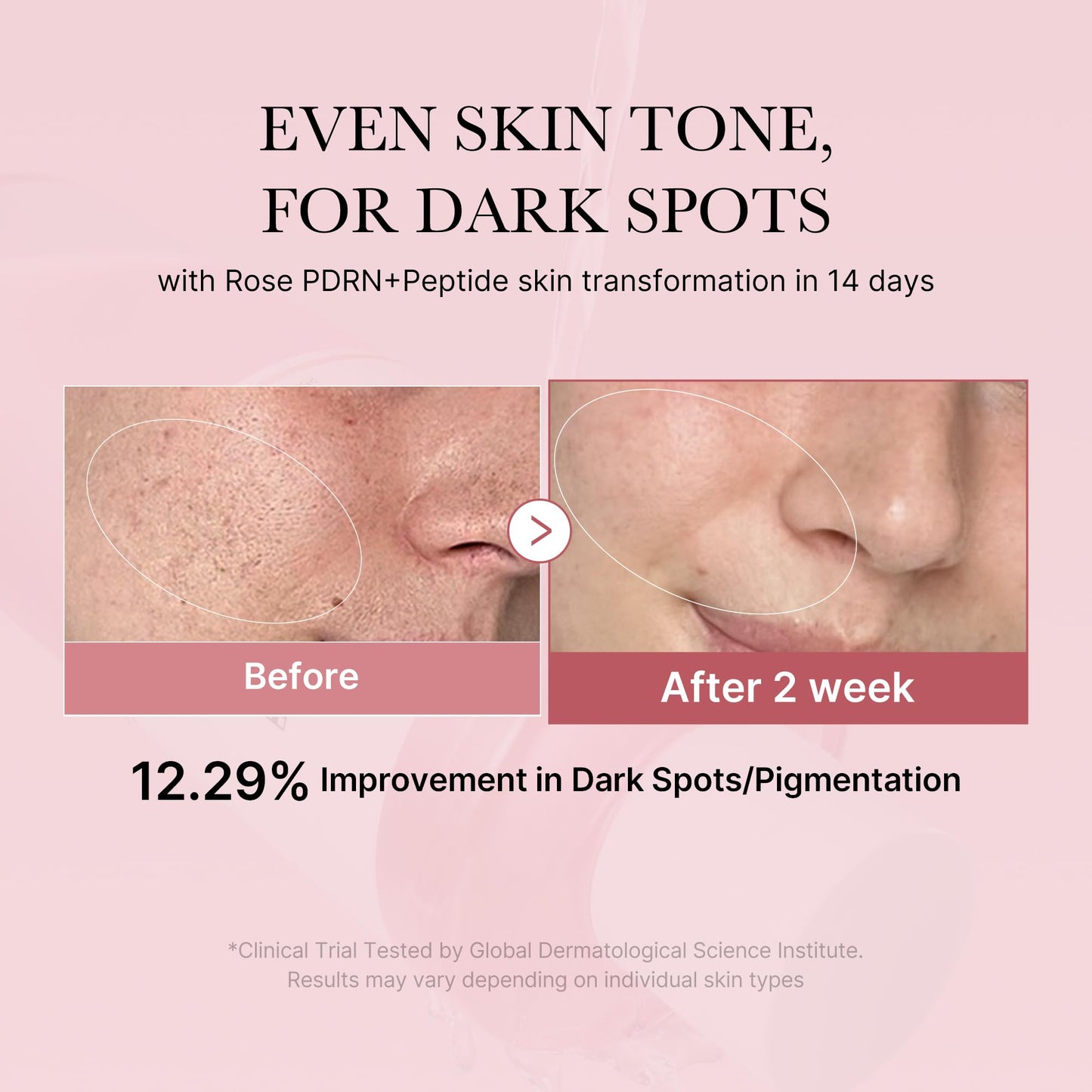 medicube PDRN Toner Rose PDRN Peptide Toner | Lightweight & Watery Type for Skin Boosting, Soothing and Calming, Uneven Skin Tone | with Rose, Peptide, Niacinamide | Korean Skincare, 8.45 fl.oz - Maple Wellness Supplements