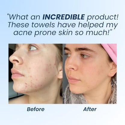 Clean Skin Club Clean Towels XL, Dermatologist Approved, 100% USDA CLEAN SKIN CLUBBuy Supplements Australia