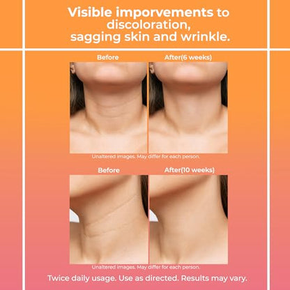 Neck Firming Cream for Women: Neck Cream - Neck Tightening Cream - Neck Creams LemcuhBuy Supplements Australia