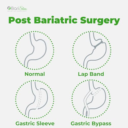 BariSlim Bariatric Calcium Citrate with Magnesium and Vitamin D Tabs - 500 mg of Calcium BariSlimBuy Supplements Australia
