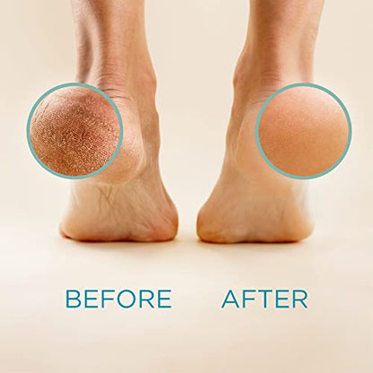 Lee Beauty Professional Callus Remover for Feet - 8 Oz, Original, Powerful Lee Beauty ProfessionalBuy Supplements Australia