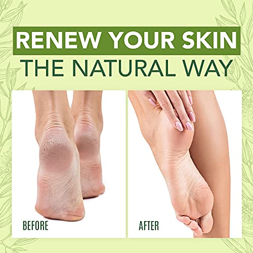 Tea Tree Oil Foot Cream For Dry Cracked Heels Repair - Natural Foot Cream For Dry Cracke USA NaturalsBuy Supplements Australia