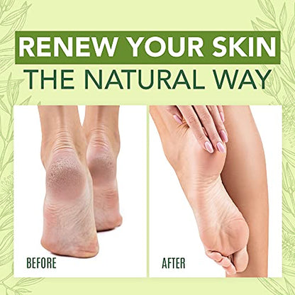 Tea Tree Oil Foot Cream For Dry Cracked Heels Repair - Natural Foot Cream For Dry Cracke USA NaturalsBuy Supplements Australia
