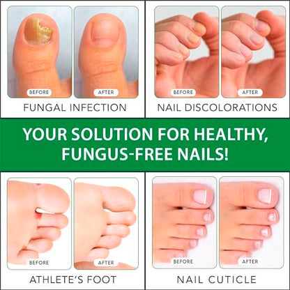 Viking Revolution Toenail Fungus Treatment Extra Strength with 1% Tolnaftate OTC Viking RevolutionBuy Supplements Australia