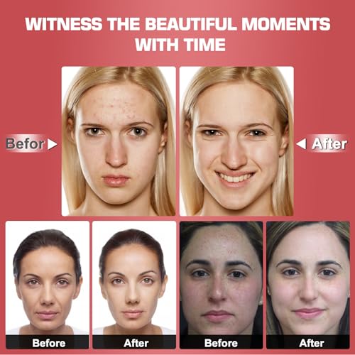 Red Light Therapy M-Ask Red Light Facial M-Ask Red Light Therapy for Face 7-1 Colors Light for Face Home Use LORICKBuy Supplements Australia