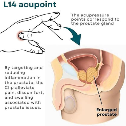 2pcs Prostate Care Point Clip for Men,Acupressure Hand Pressure Point Clip, Relieve Prostate DEFUAUKEBuy Supplements Australia