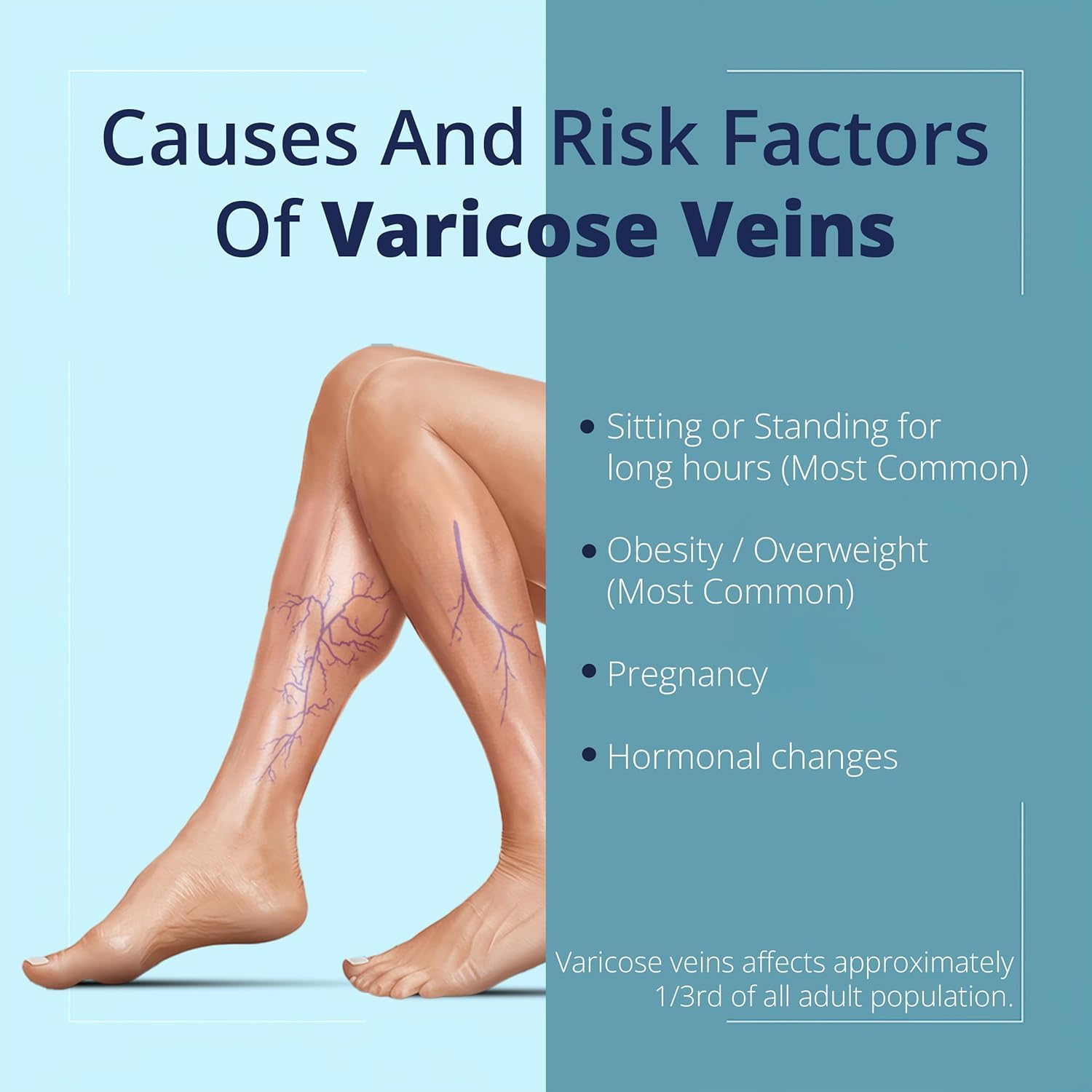 Cream Ayurvedic Solution for Management of Varicose Veins, Spider Veins, Varicocele Helps Reach The Root Cause of varicose Veins Reduces Cramps, Itching & Swelling. Single Tube (25 GMS). GenericBuy Supplements Australia