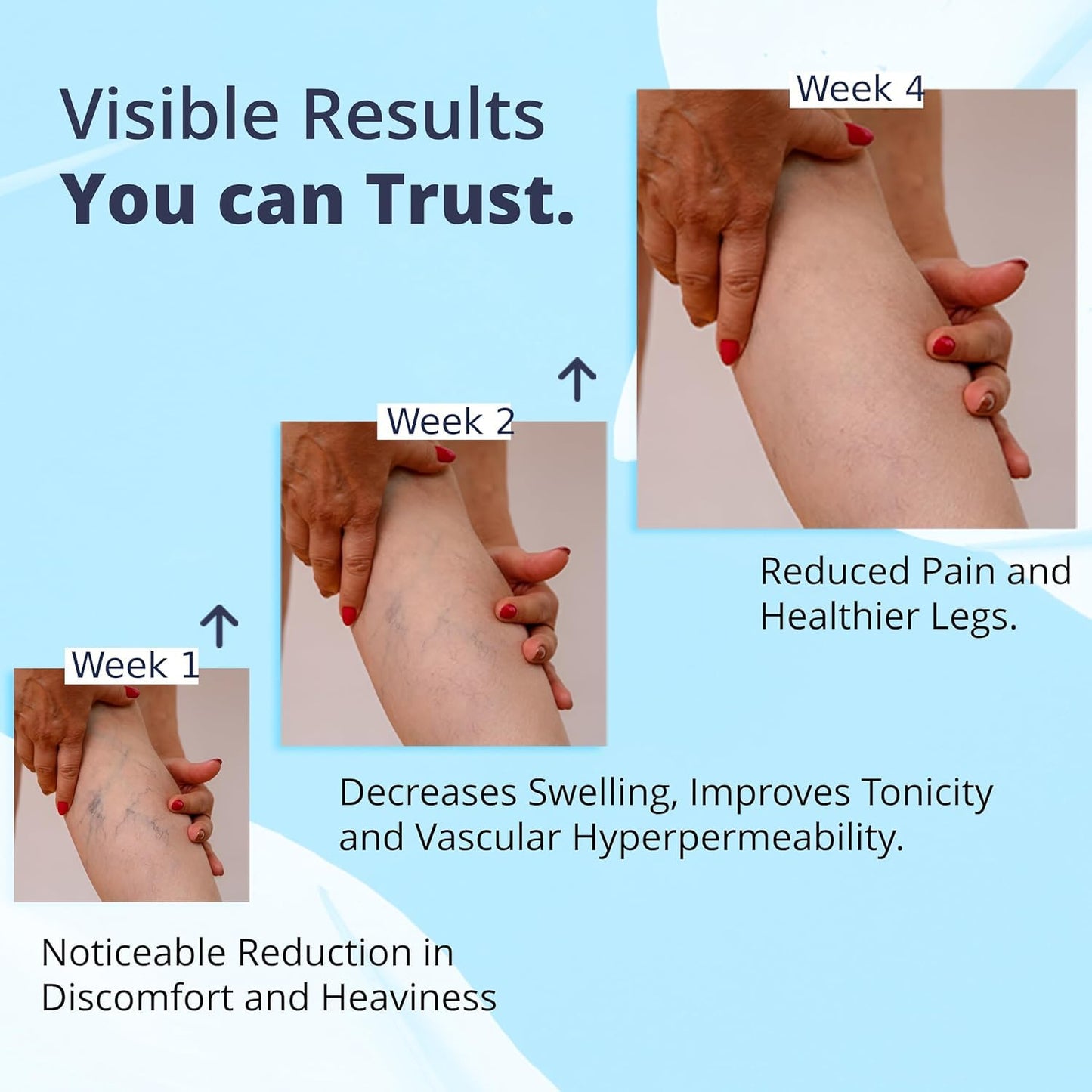 Cream Ayurvedic Solution for Management of Varicose Veins, Spider Veins, Varicocele Helps Reach The Root Cause of varicose Veins Reduces Cramps, Itching & Swelling. Single Tube (25 GMS). GenericBuy Supplements Australia