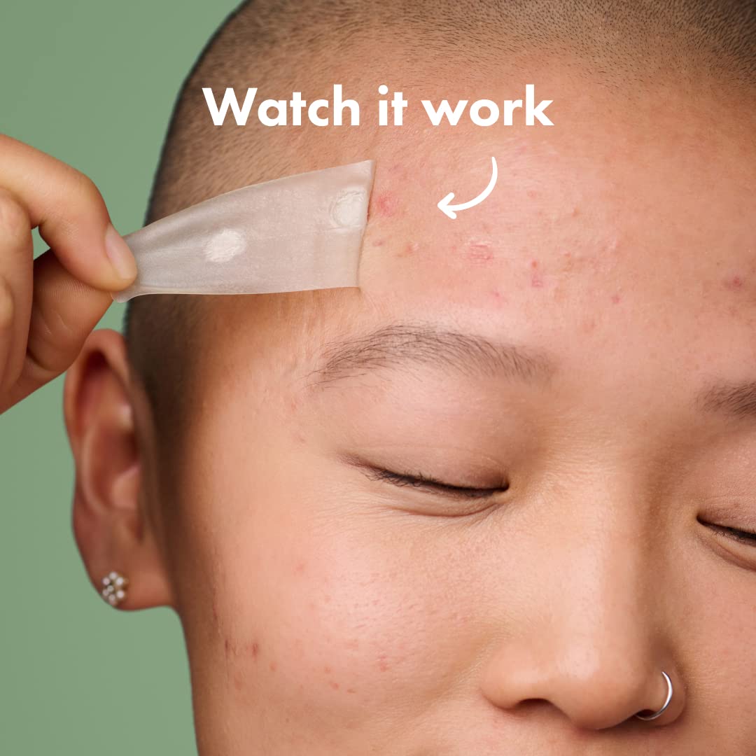 Mighty Patch™ Surface patch from Hero Cosmetics - Hydrocolloid Spot Patch for Body Mighty PatchBuy Supplements Australia