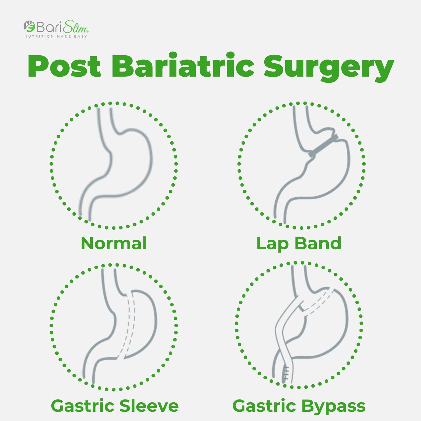 BariSlim Bariatric Calcium Citrate Plus Powder - Formulated for Patients After Weight Loss BariSlimBuy Supplements Australia