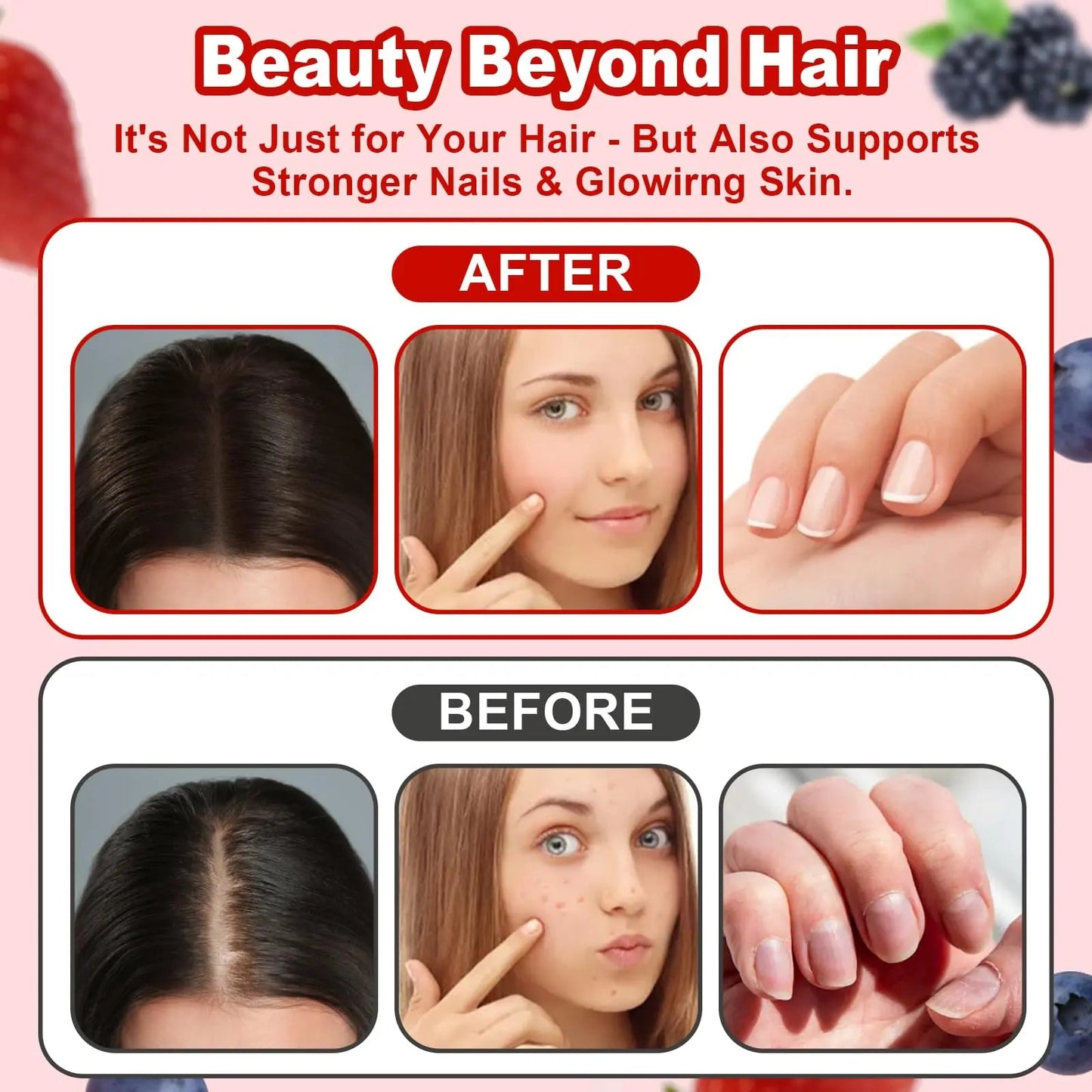 LUIMOLL Lumin Hair Growth Gummies – Daily Hair Nourishment with Biotin, Collagen & Botanical Extracts – Supports Thicker, Stronger & Healthier-Looking Hair LUIMOLLBuy Supplements Australia