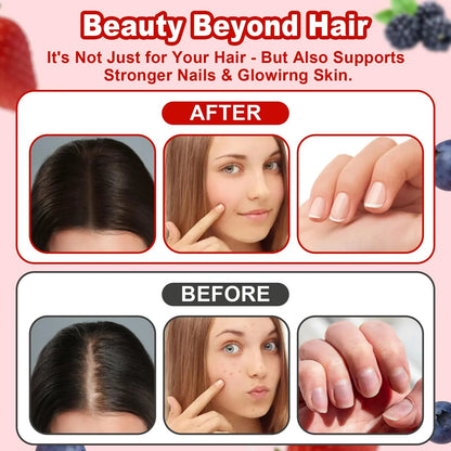 LUIMOLL Lumin Hair Growth Gummies – Daily Hair Nourishment with Biotin, Collagen & Botanical Extracts – Supports Thicker, Stronger & Healthier-Looking Hair LUIMOLLBuy Supplements Australia