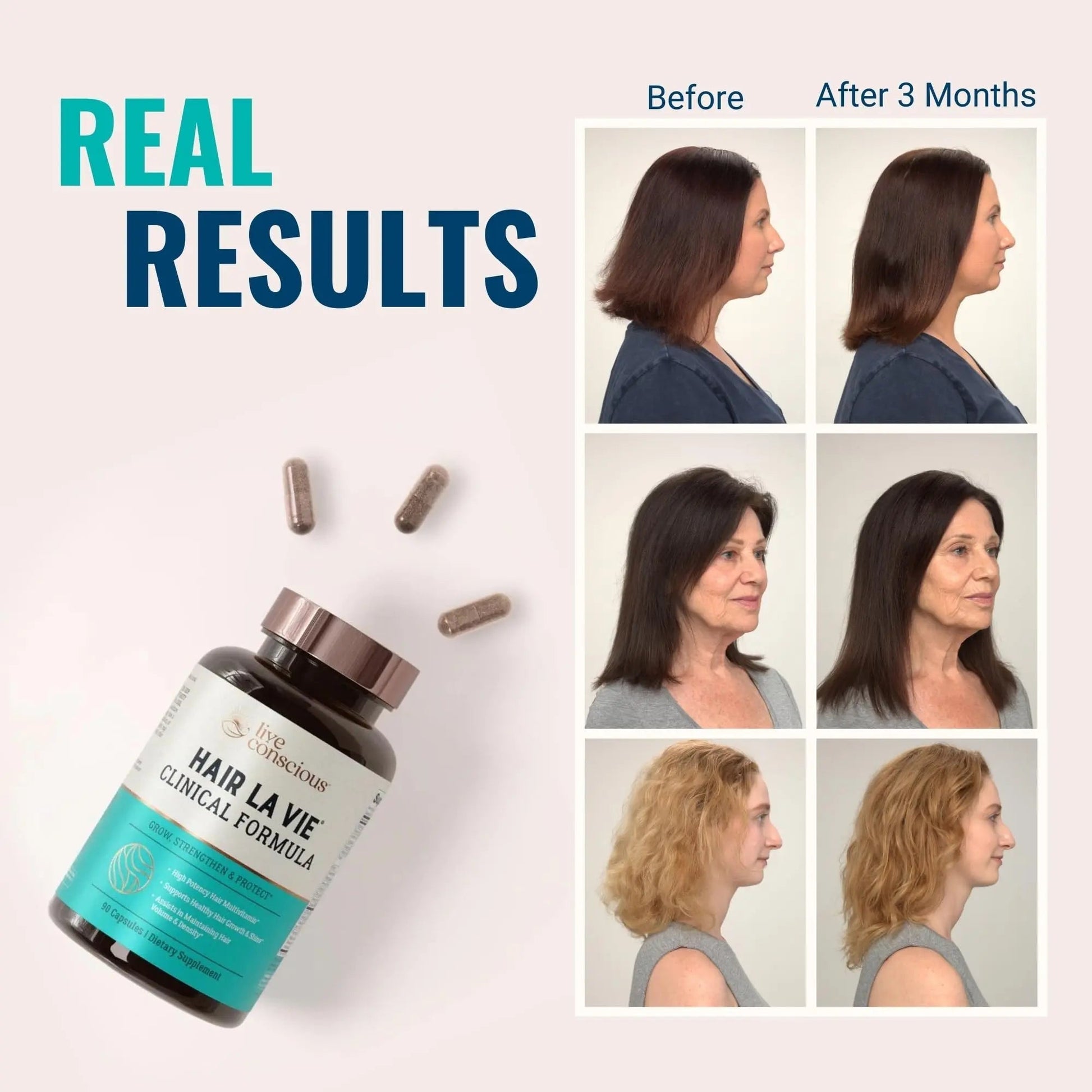 Hair La Vie Live Conscious Clinical Formula Hair Growth Vitamins for Women and Men w/Biotin, Collagen & Saw Palmetto (Pack of 1) Hair La VieBuy Supplements Australia