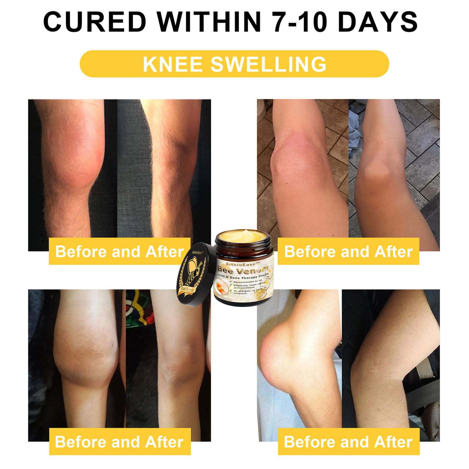 ArthroEase Bee Venom Joint and Bone Cream,ArthroEase Bee Venom Cream,Bee Venom Joint Gel,Effectively Relieve Joint discomfort (2) ADFIREBuy Supplements Australia