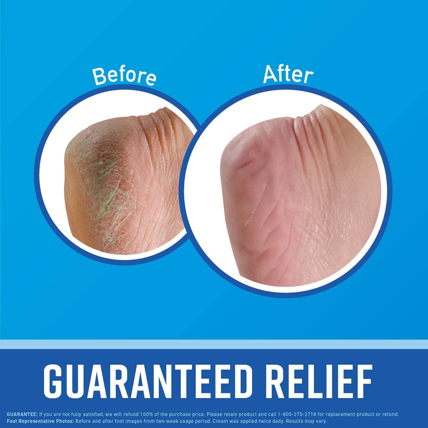 O'Keeffe's for Healthy Feet Foot Cream, Guaranteed Relief for Extremely Dry, Cracked Feet O'Keeffe'sBuy Supplements Australia
