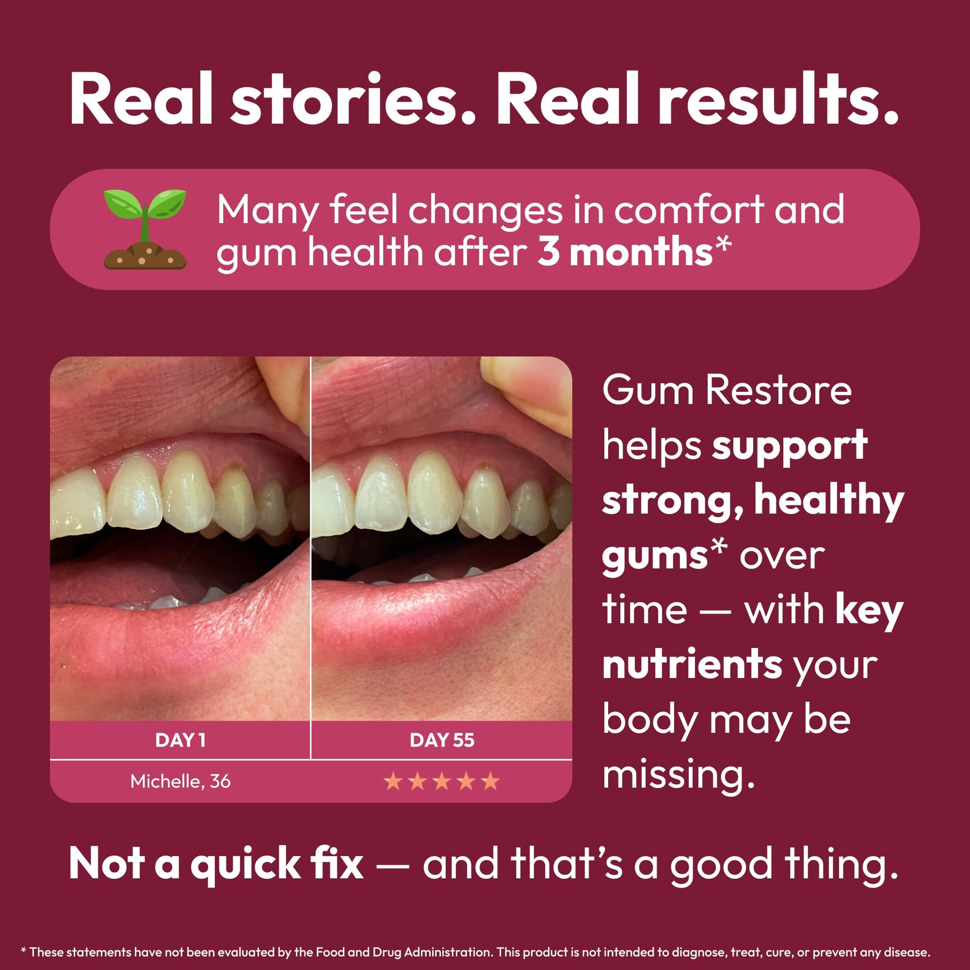 Strong Jaw Gum Restore - Gum Repair for Receding Gums | Teeth Magnesium Supplements, Oral Care, Remineralizing Dental Health Vitamins for Adults | 1 Month Supply, 180 Capsules, Made in USA Strong JawBuy Supplements Australia