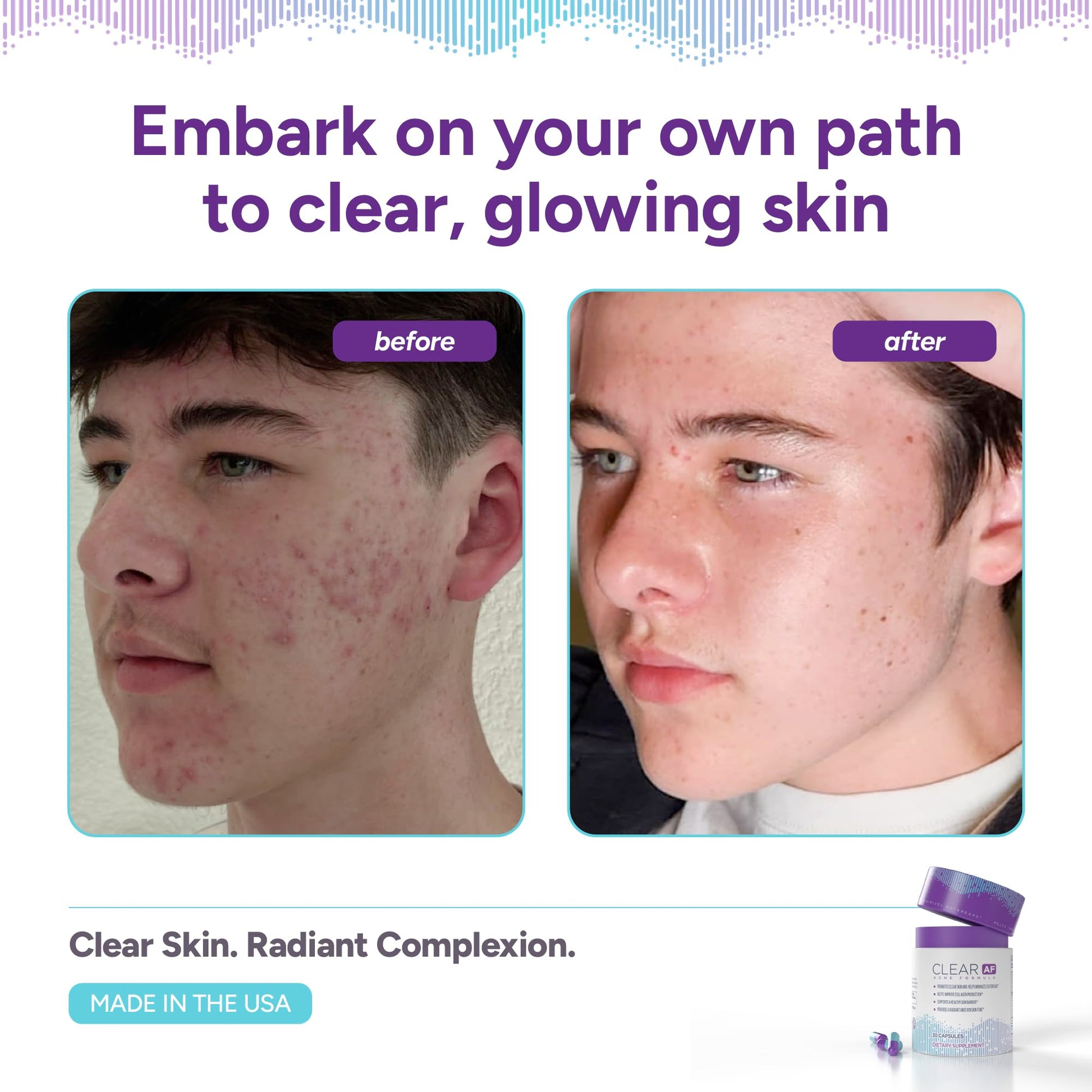 Clear AF Clear Skin Supplement | Skin Barrier Hydration & Clear Complexion Support with Vegan Ceramides, Zinc, Vitamin D3, B6, Riboflavin & Thiamine | Vegan Capsules | 30-Day Supply Clear AFBuy Supplements Australia