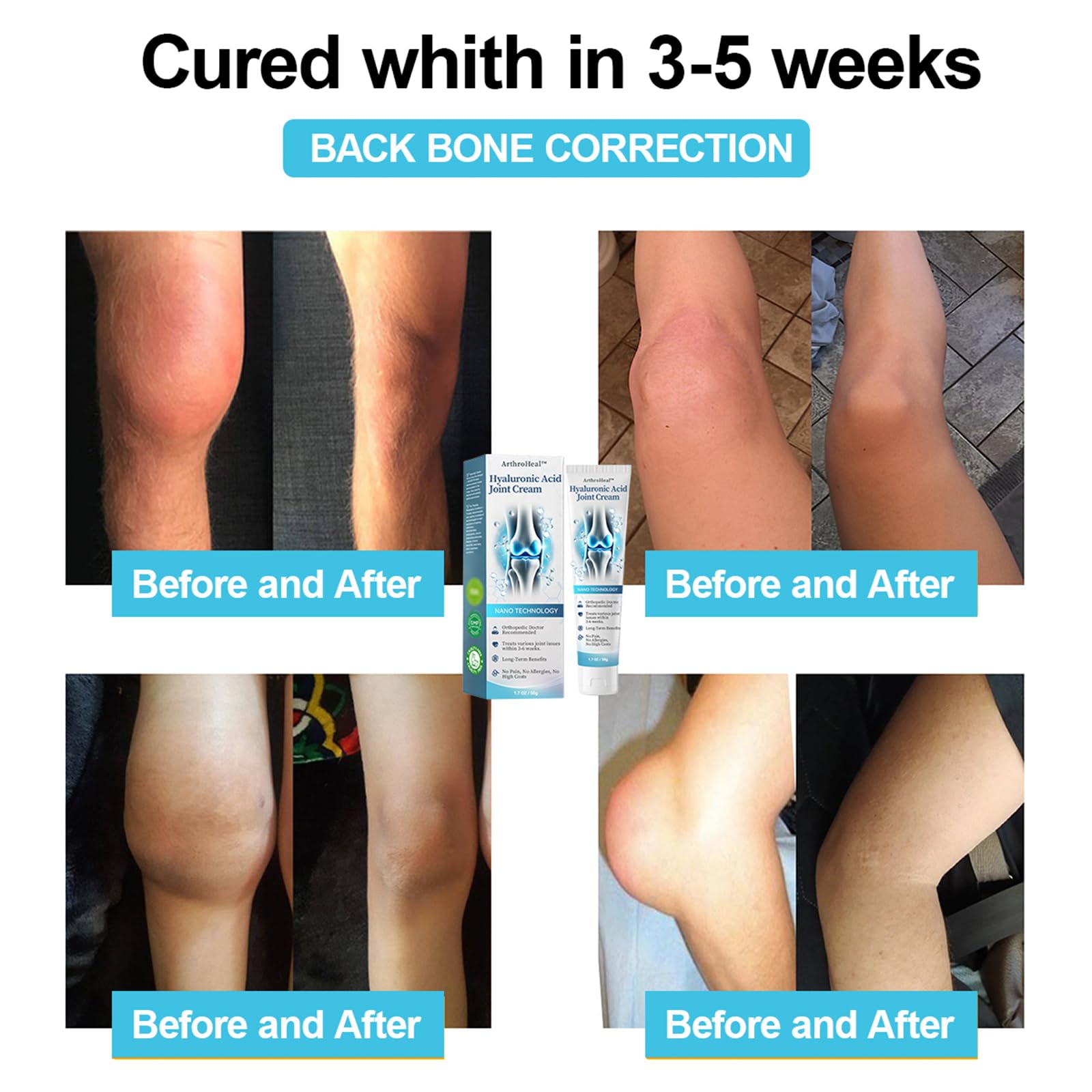 Luhaka ArthroHeal Hyaluronic Acid Joint R-epair Cream,ArthroHeal Joint Cream,Quickly relieve joint discomfort, Quickly relieve joint discomfort, suitable for joint activities throughout the body (1) LuhakaBuy Supplements Australia