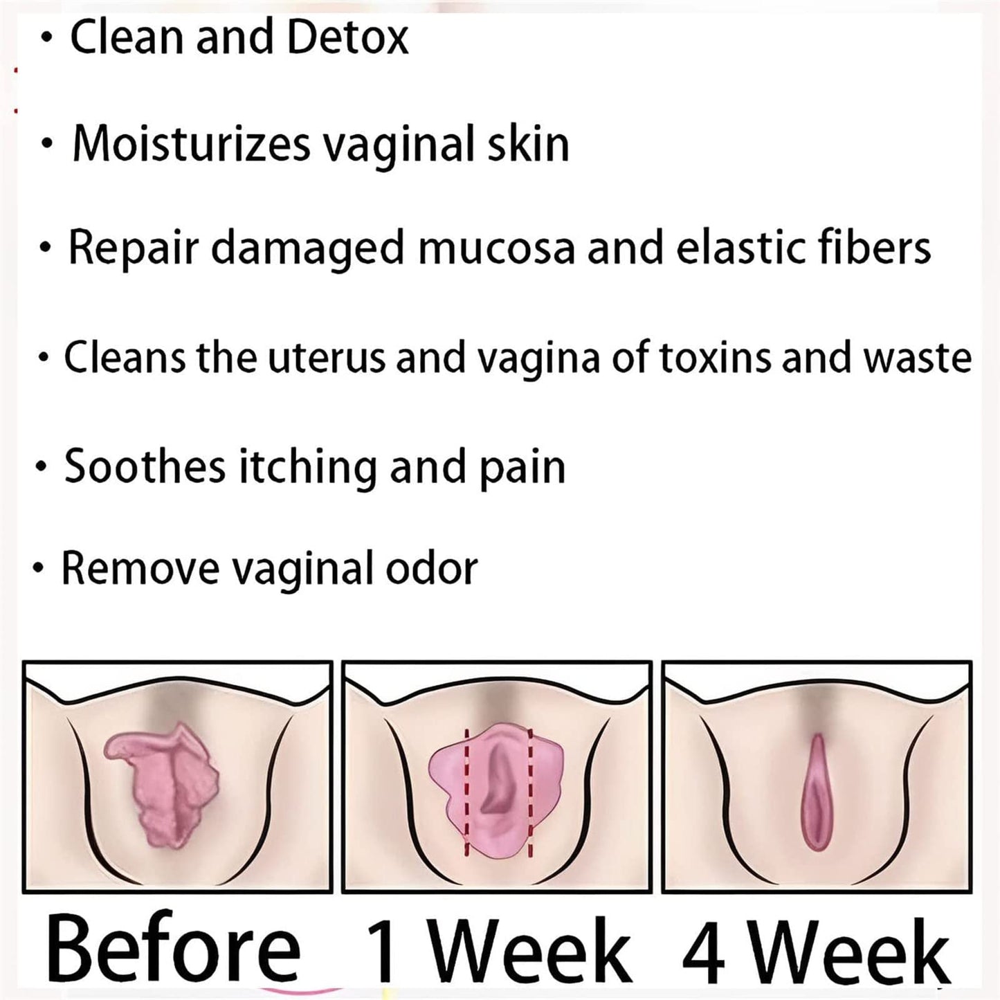 AnnieCare Instant Anti-Itch Detox Slimming Products, Annie Care Natural Detox Viginal Gel DASHENRANBuy Supplements Australia