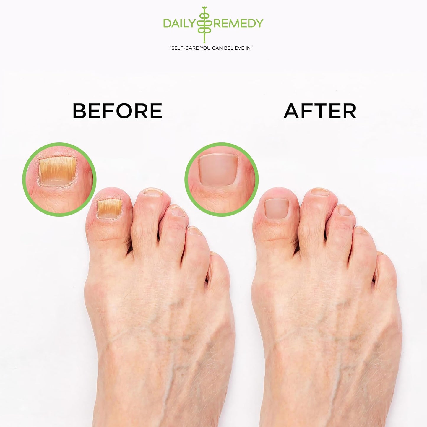 Tea Tree Oil Foot Soak with Epsom Salt - Made in USA - for Toenail Athletes Foot DAILY REMEDYBuy Supplements Australia