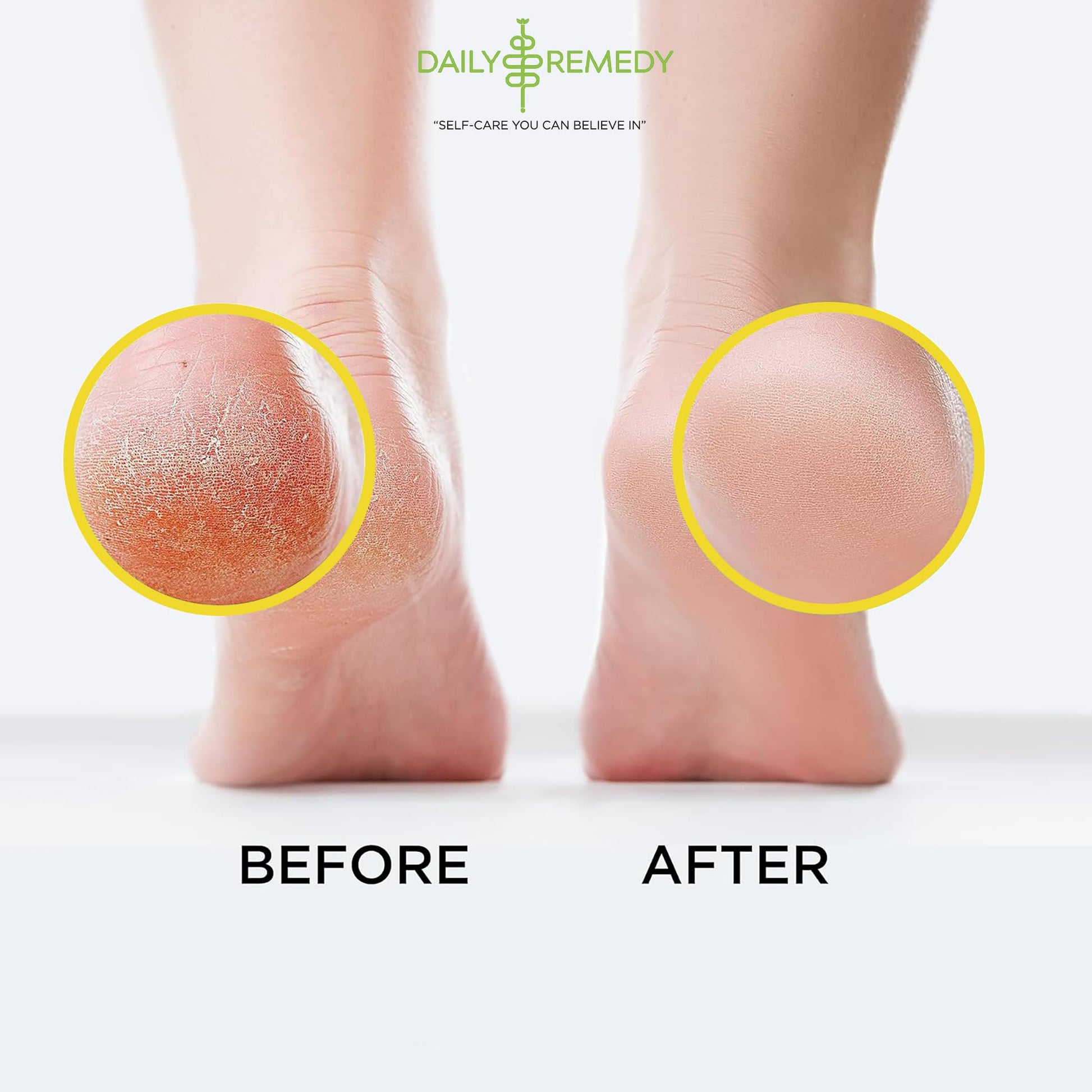 Citrus Detox Foot Soak with Epsom Salt - for Foot Callus, Immune Boost, Damaged Toenail DAILY REMEDYBuy Supplements Australia