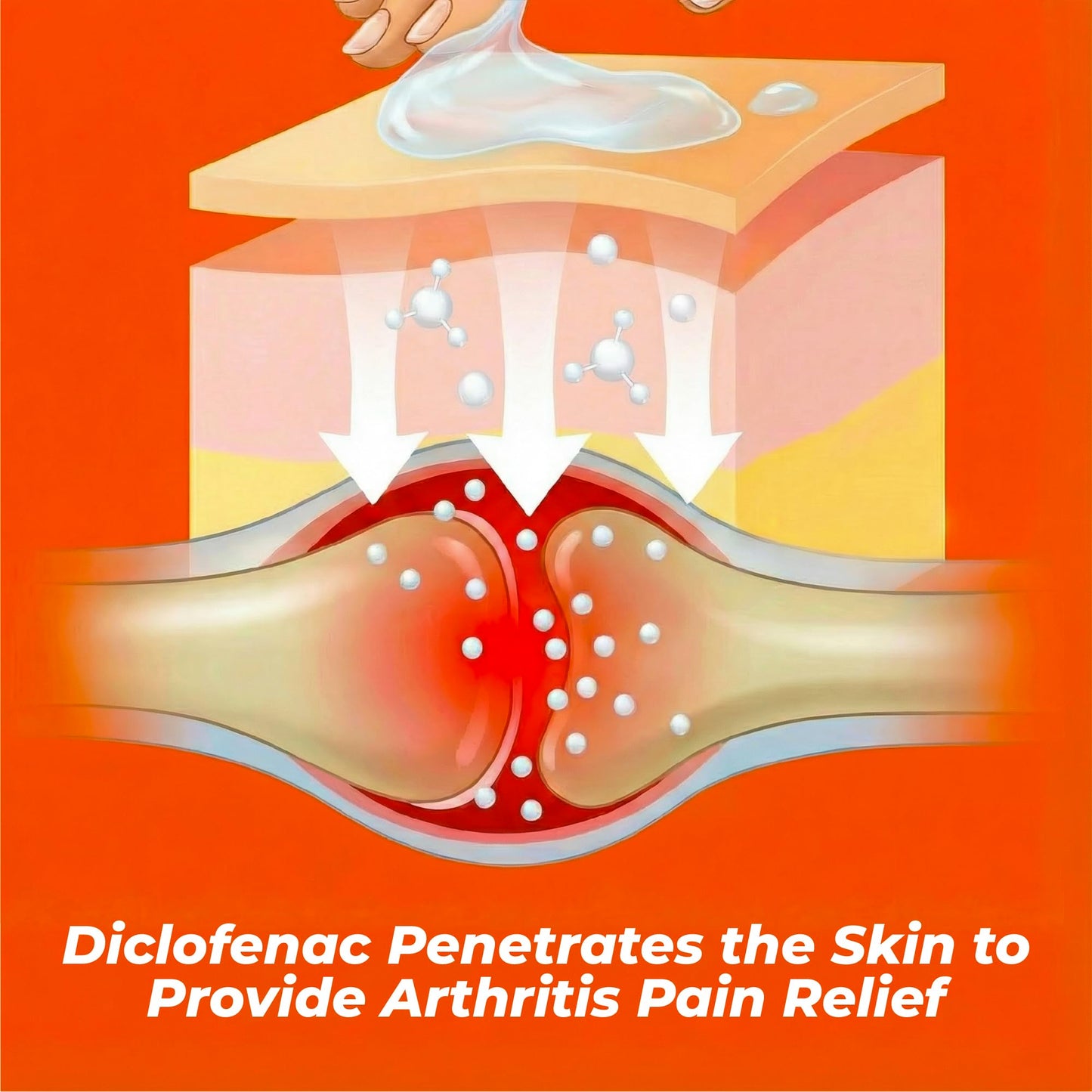 Aspercreme Arthritis Pain Relief Gel for Arthritis & Joint Pain, Non-steroidal Anti-inflammatory Topical Gel with Max-Strength Diclofenac Sodium, 100 g AspercremeBuy Supplements Australia
