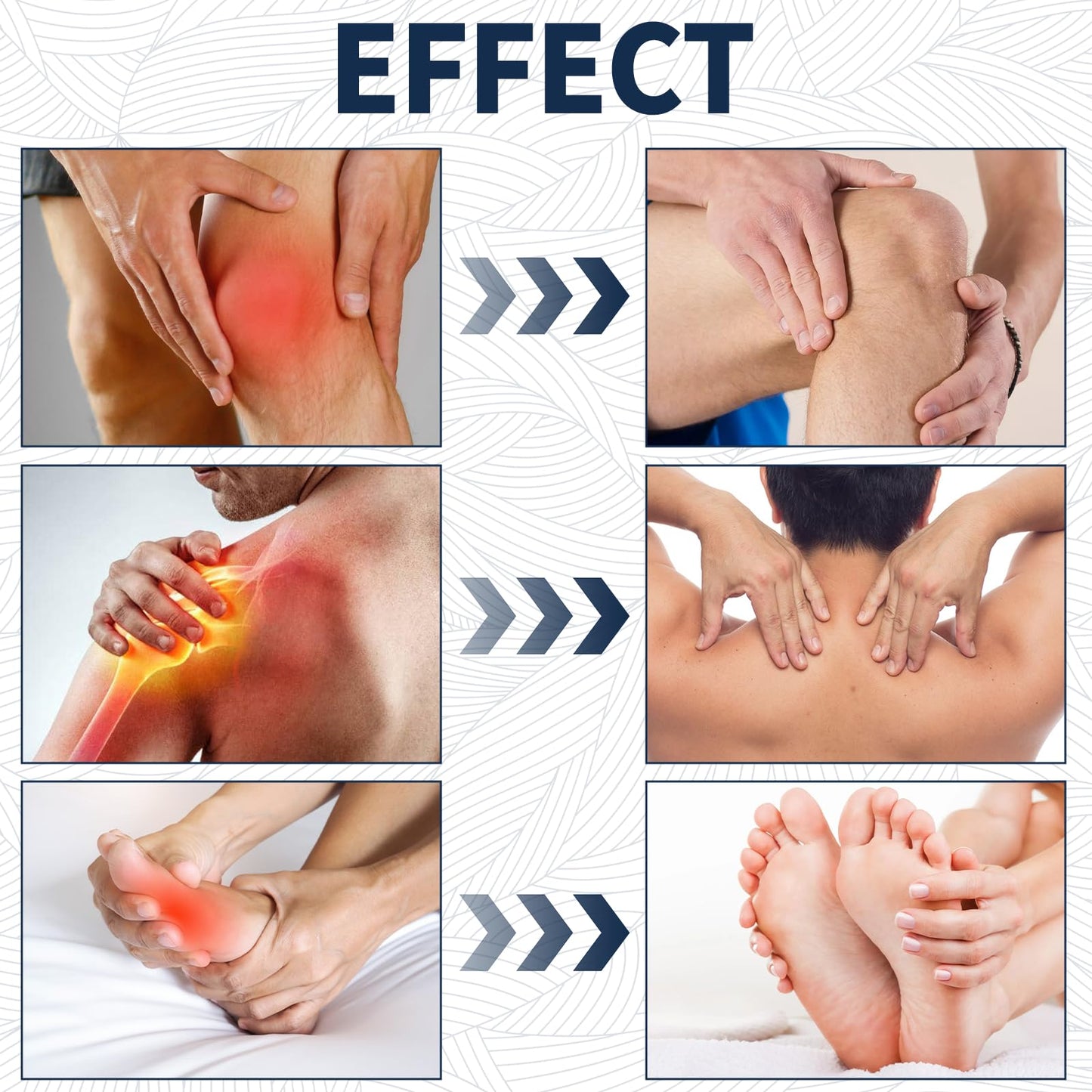 YIVANNUO 2PCS Neuropathy Relief Cream, Contains Arnica, Menthol, Msm, and Glucosamine, Suitable for Feet, Hands, Legs, Muscles, Joints, and Waist, Fast Absorption, Mild & All Natural YIVANNUOBuy Supplements Australia