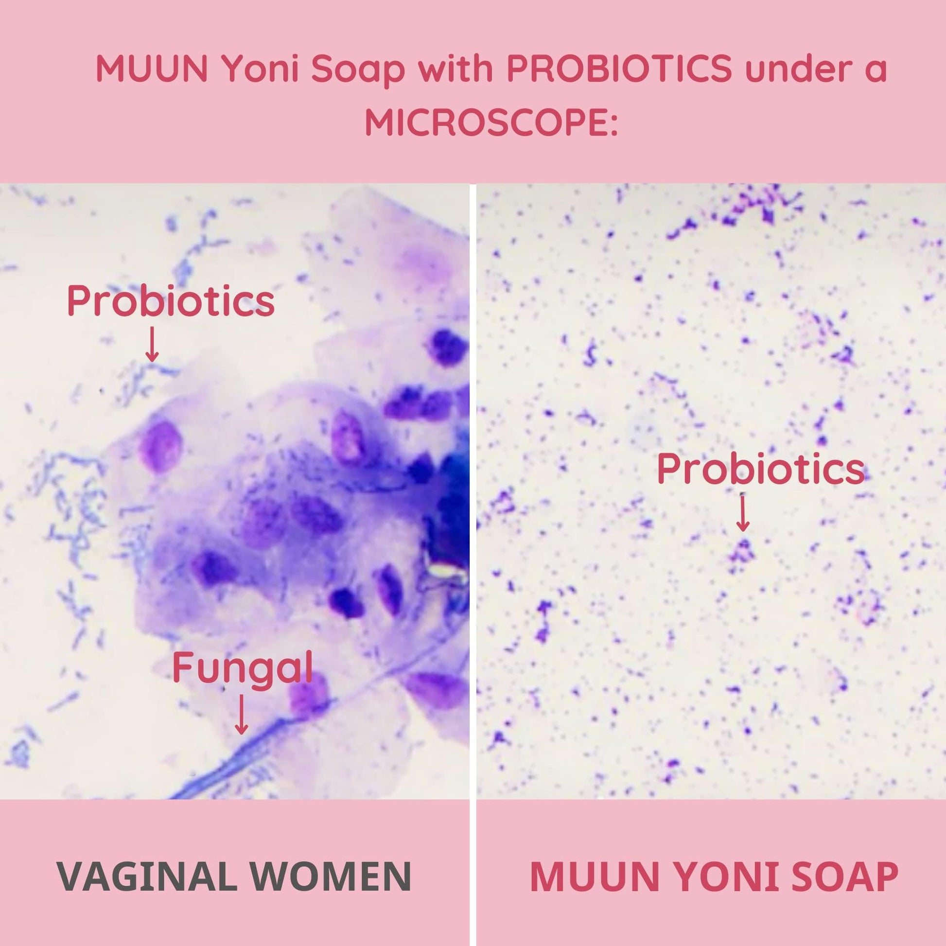 Muun Yoni Soap Bar - Pack 3 Ph Balance Probiotics & Natural Ingredients - Gentle Cleansing Formula MuunBuy Supplements Australia