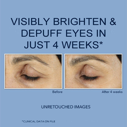 RoC Retinol Correxion Eye Cream Mini for Dark Circles & Puffiness, Daily Wrinkle RoCBuy Supplements Australia
