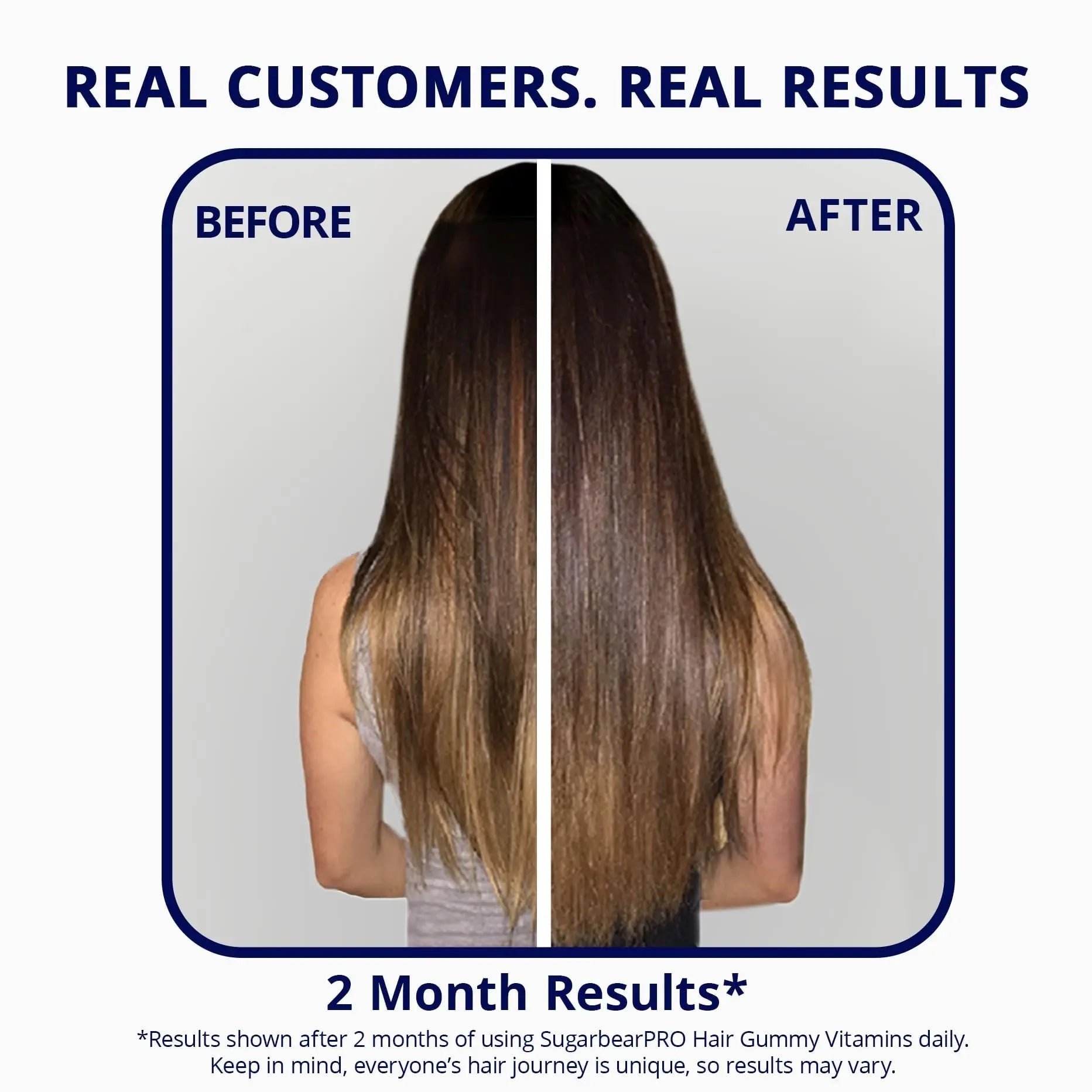 SugarBearPro Hair Vitamin Gummy 3 Month Supply Extra Strength Biotin 6000mcg, Growth for Men & Women, Vegan Vitamin B12 SugarBearHairBuy Supplements Australia