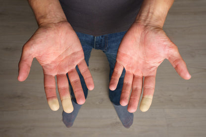 Extremity Warmth - for Cold Hands and Feet GenericBuy Supplements Australia