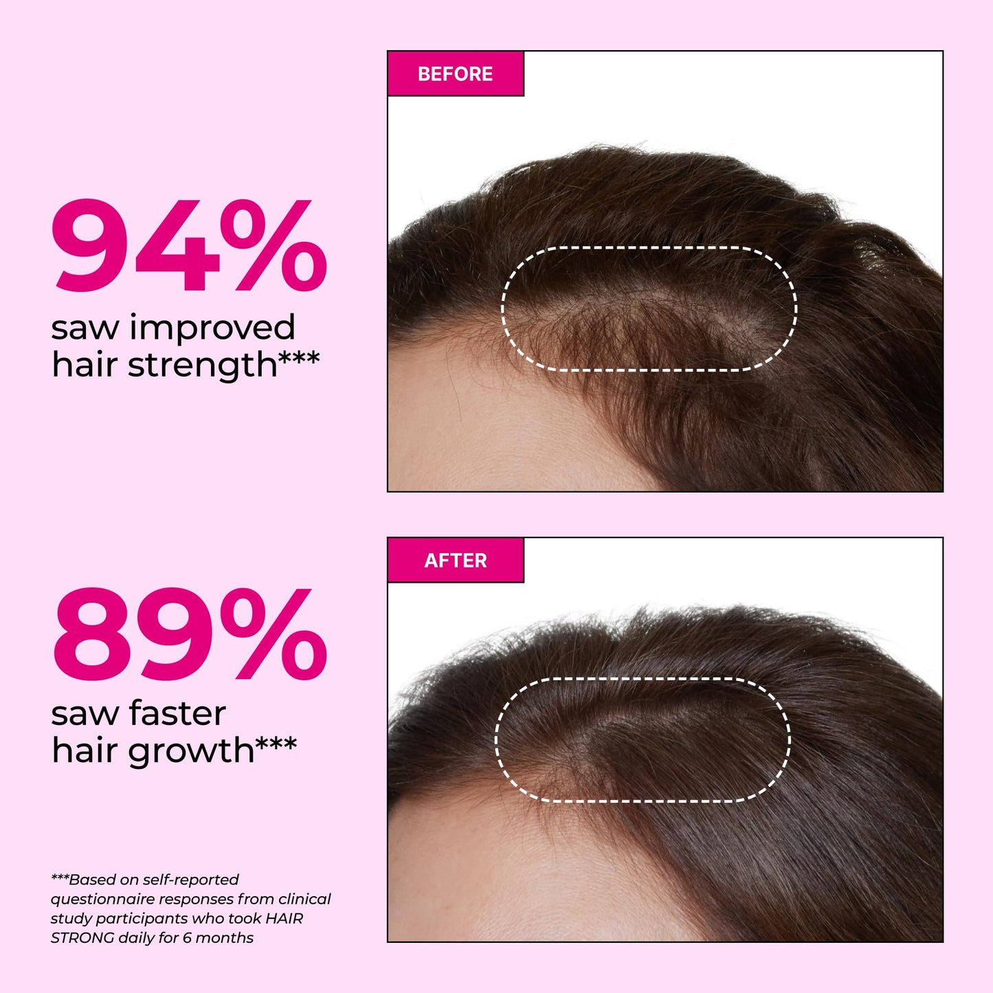 HUM Hair Strong Daily Hair Growth Gummies with Biotin, Zinc, Vitamin B12 to Support Growth, Folic Acid & Vitamin B12 Gummy Vitamins for Healthy Hair Support for Women and Men, 60 Gummies HUMBuy Supplements Australia
