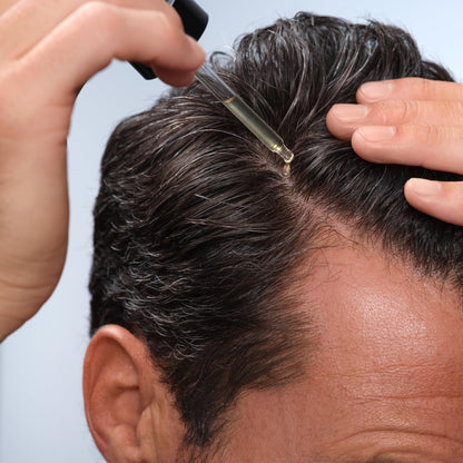 Caldera + Lab The Hair Serum | Men’s Thickening Serum for Thinning & Receding Hair, Supports Fuller & Stronger-Looking Hair, Dermatologically Tested - All Hair Types Caldera + LabBuy Supplements Australia
