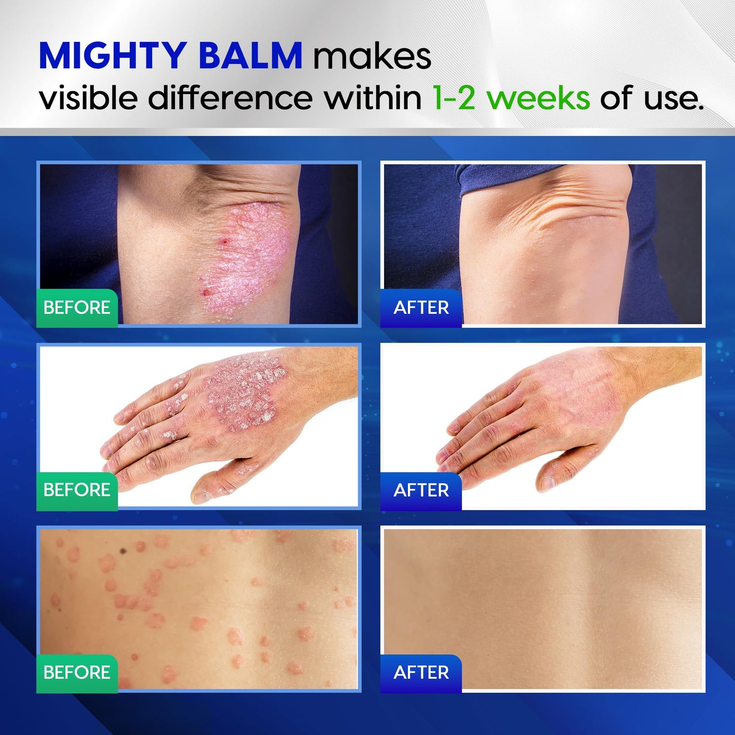 Tobcharm Antifungal Cream, Antifungal Cream for Skin, Ringworm Treatment for Humans TobcharmBuy Supplements Australia