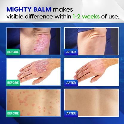 Tobcharm Antifungal Cream, Antifungal Cream for Skin, Ringworm Treatment for Humans TobcharmBuy Supplements Australia