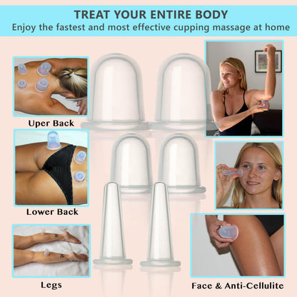 Cupping Kit for Massage Therapy - by DoSensePro, Cupping Set of 6 Professional Silicone Cups DoSenseProBuy Supplements Australia