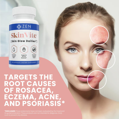 Zen Nutrients SkinVite Natural Skin Supplement for Women, Men & Teens - Hormonal Breakouts & Clear Skin Support Supplement - Detoxifying Vitamin for Acne and Digestion Support Zen NutrientsBuy Supplements Australia