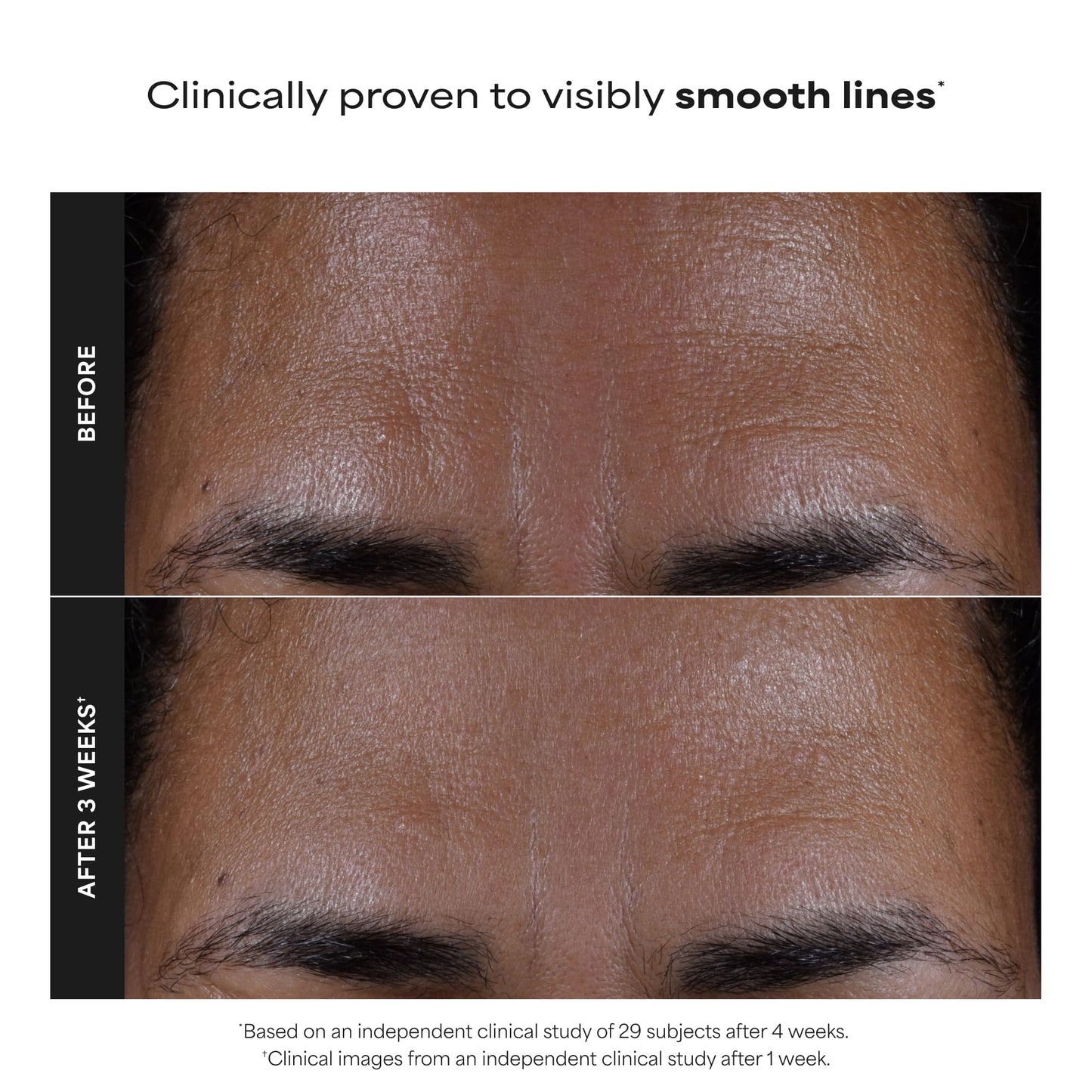Paulas Choice--SKIN PERFECTING 2% BHA Liquid Salicylic Acid Exfoliant--Facial Exfoliant
