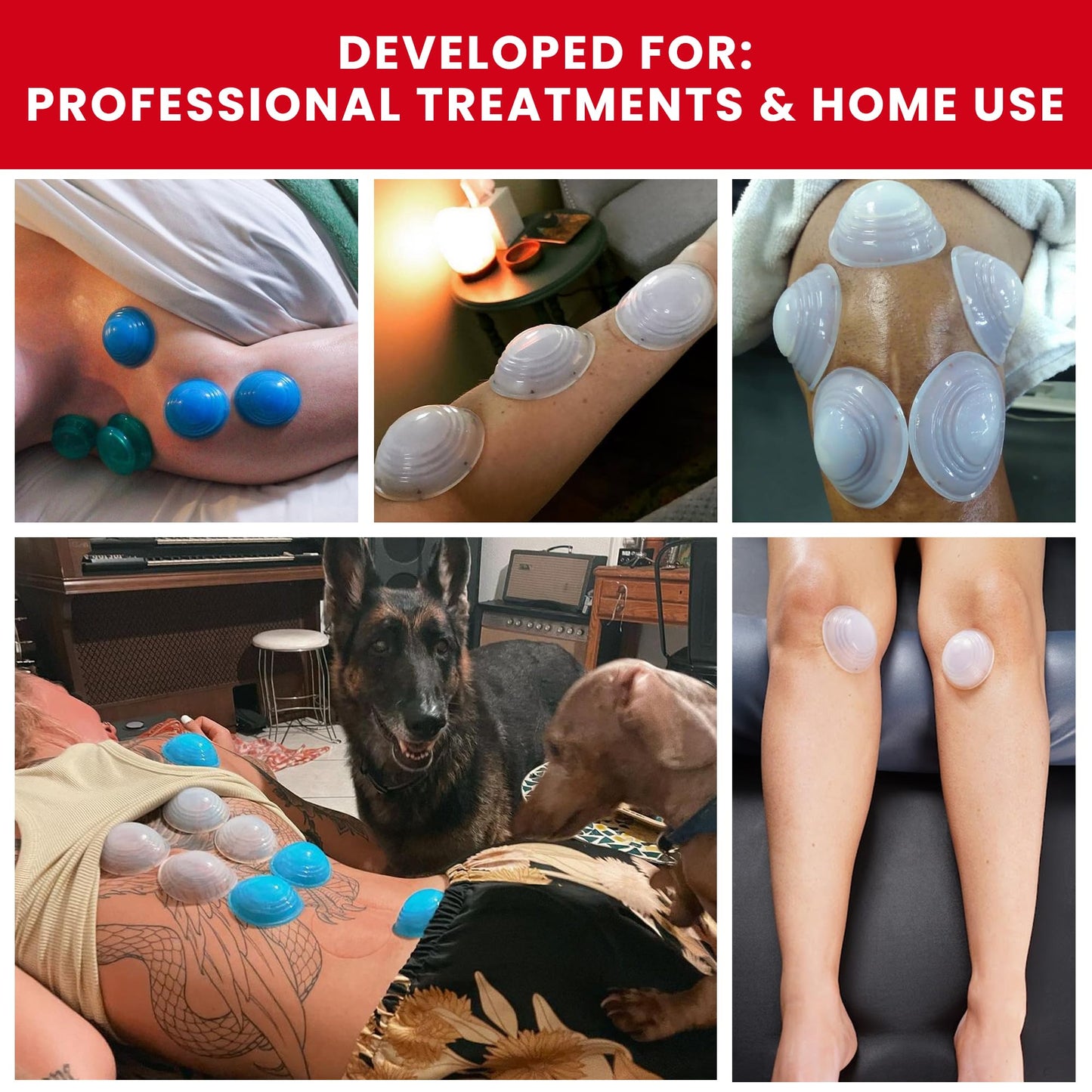 Lure Essentials Cupping Therapy Set 10 Professional Silicone Cupping Cups for Muscle Knots, Joints, Muscles, Arms and Feet Lure EssentialsBuy Supplements Australia