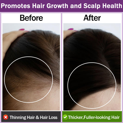 Rosemary Oil for Hair Growth,100% Pure Undiluted Light-Weight Non-Greasy Rosemary Essential Oil GIFBEABuy Supplements Australia