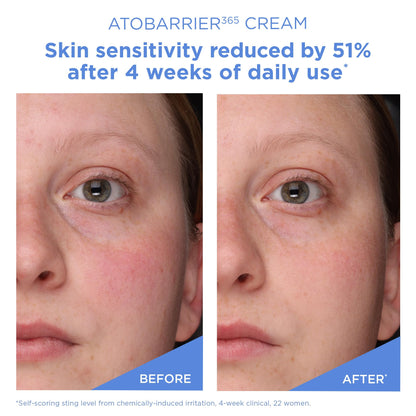 AESTURA ATOBARRIER365 Cream with Ceramides, Korean Face Moisturizer for Barrier Repair | 120H lasting Hydration, Ceramide Capsules - Maple Wellness Supplements