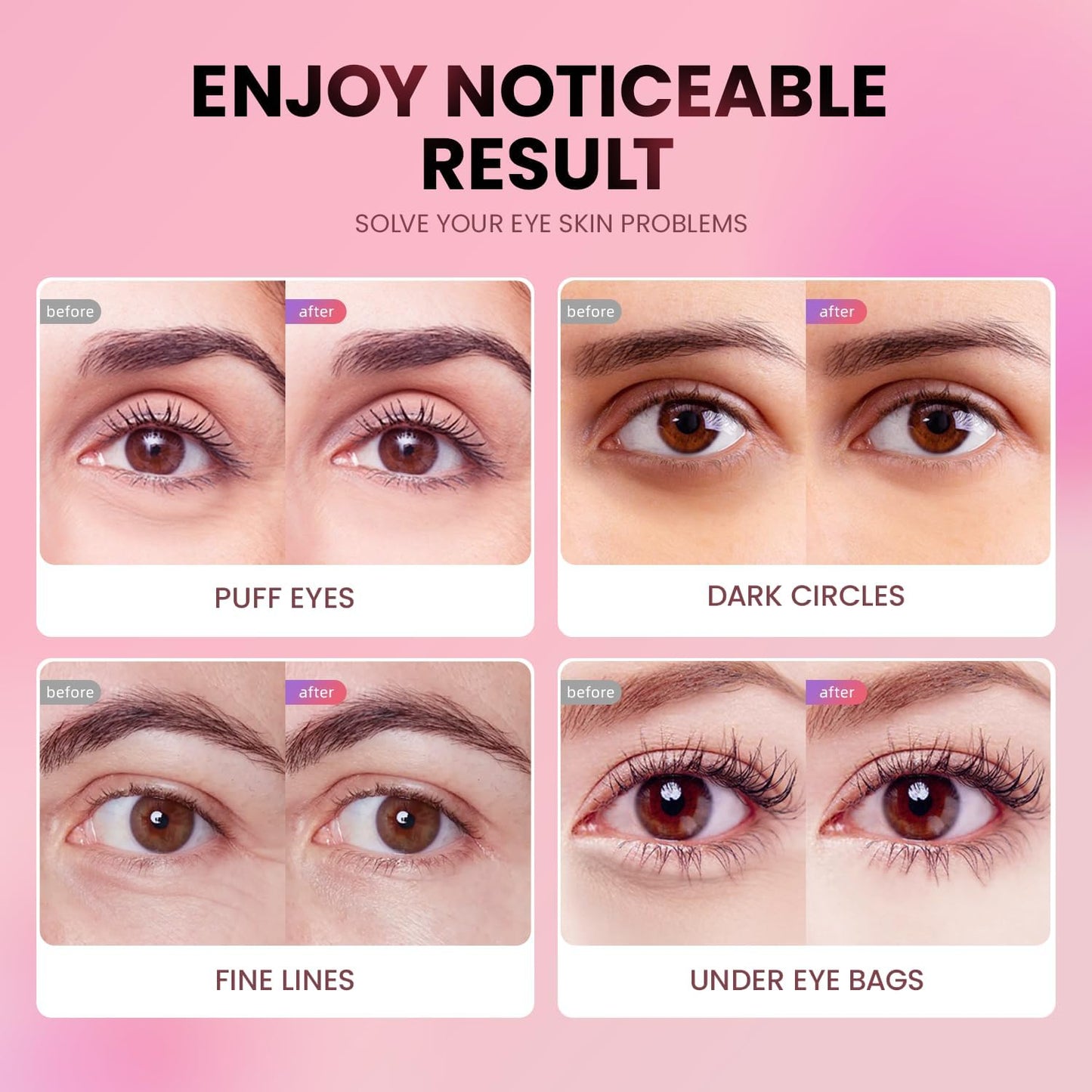 AILEORY Under Eye Patches (24 Pairs) - Tri-color Glitter Eye Gel Pads for Dark Circles, Puffy Eyes, Under eye Bags, Wrinkles - Maple Wellness Supplements