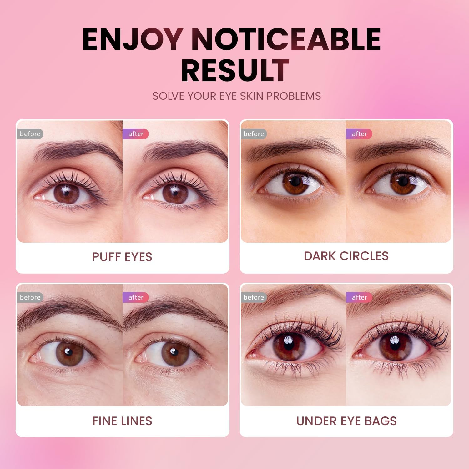 AILEORY Under Eye Patches (24 Pairs) - Tri-color Glitter Eye Gel Pads for Dark Circles, Puffy Eyes, Under eye Bags, Wrinkles - Maple Wellness Supplements