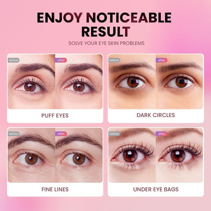 AILEORY Under Eye Patches (24 Pairs) - Tri-color Glitter Eye Gel Pads for Dark Circles, Puffy Eyes, Under eye Bags, Wrinkles - Maple Wellness Supplements