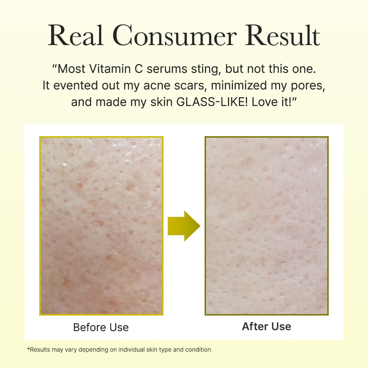 Arencia Vitamin C Booster Shot Serum with Glutathione, Niacinamide and Vitamin E for Dark Spot Care, Fine Lines & Wrinkles - Maple Wellness Supplements