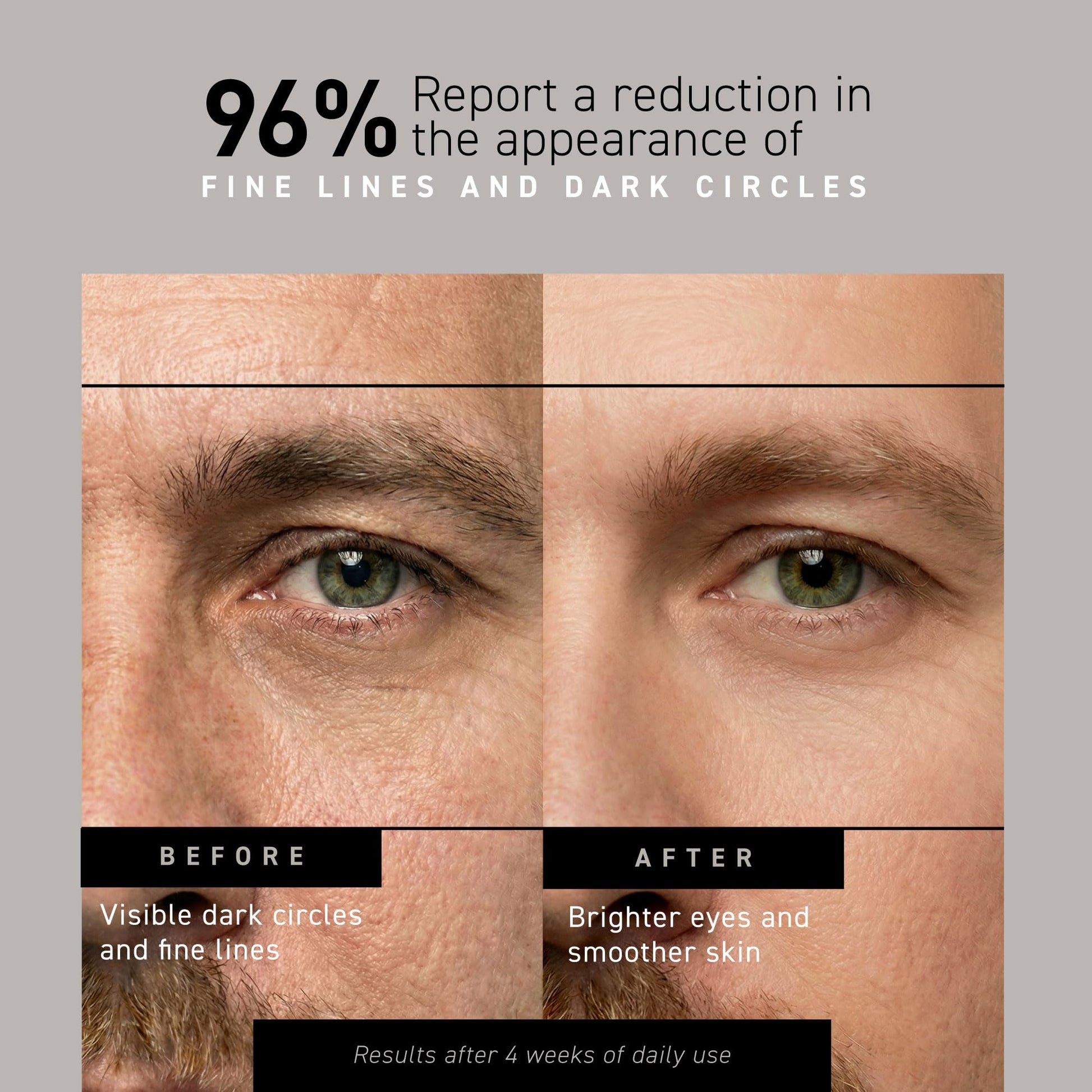 Brickell Men's Restoring Under Eye Cream for Men, Natural and Organic Anti Aging Eye Balm To Reduce Puffiness, Wrinkles, Dark Circles - Maple Wellness Supplements