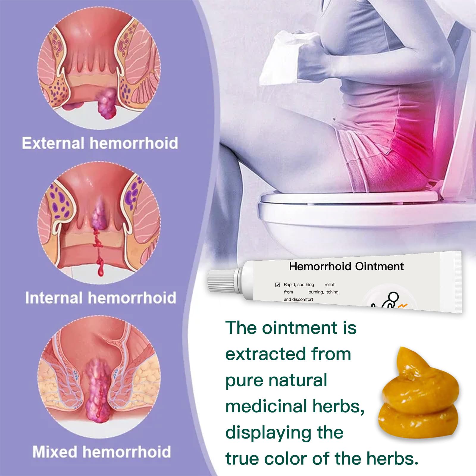 BXQJRJ Hemorrhoid Ointment,Herbal hemorrhoid Gel,Effectively relieves Anal discomfort,Suitable for Men and Women,Fast-Acting hemorrhoid Ointment (20g) - Maple Wellness Supplements