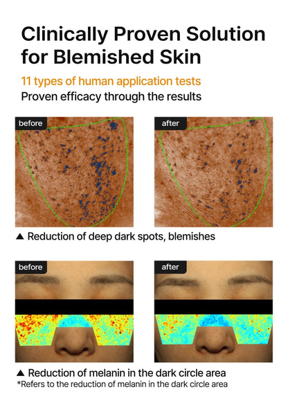 celimax Pore+Dark Spot Brightening Cream | with Niacinamide, Tranexamic Acid, TXA Cream - Maple Wellness Supplements