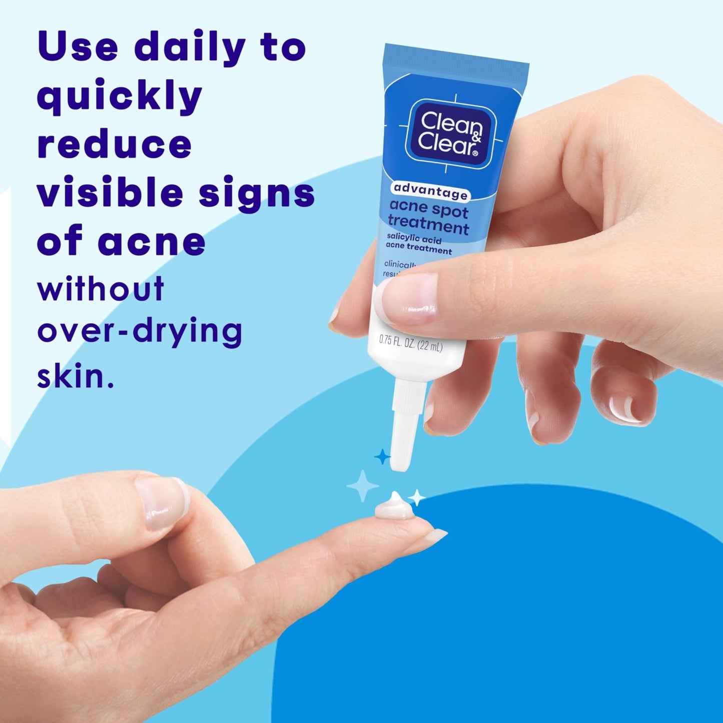 Clean and Clear Advantage Acne Spot Treatment Gel Cream with 2% Salicylic Acid & Witch Hazel, Acne Pimple Medication - Maple Wellness Supplements