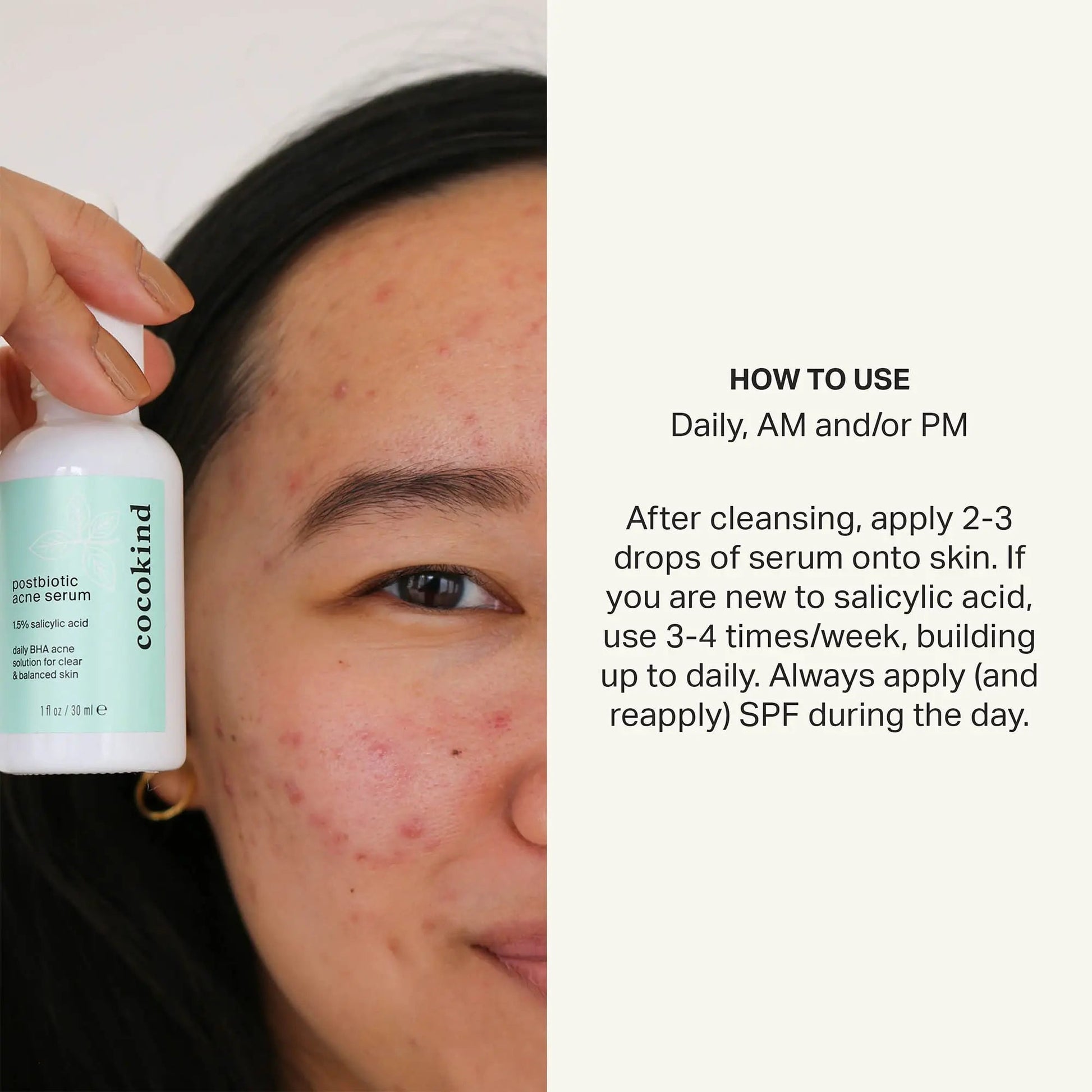 Cocokind Postbiotic Acne Serum, Salicylic Acid Serum and BHA Liquid Exfoliant - Exfoliating, Brightening and Hydrating Serum - Maple Wellness Supplements